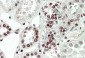 MK5 / MAPKAPK5 (aa192-206) Antibody (internal region)